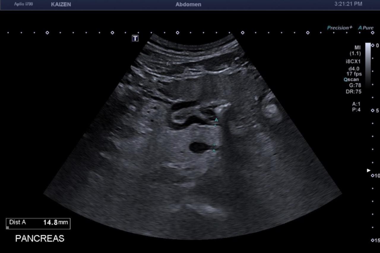 Imagen de ecografía general